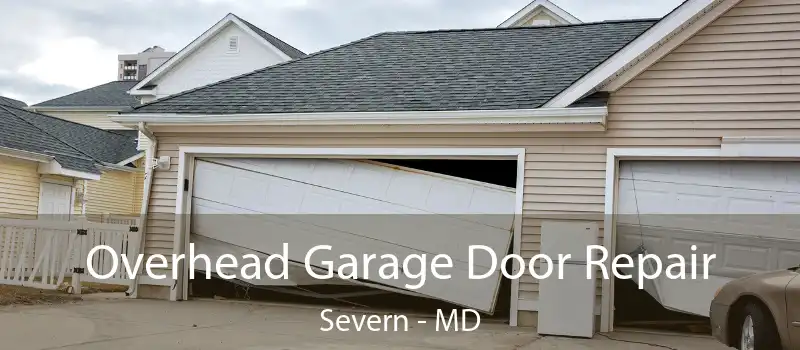  Overhead Garage Door Repair Severn - MD
